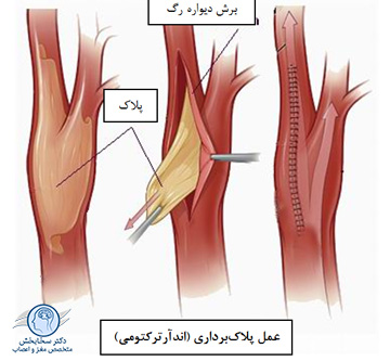 یمنینتبرب
